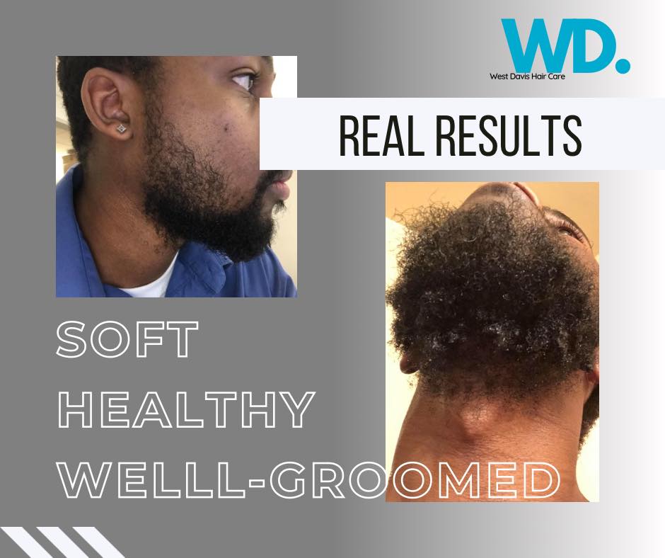 Men Beard Growth Oil
