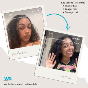 Breakage and Hair Loss in Houston: What Black Women Over 40 Should Know